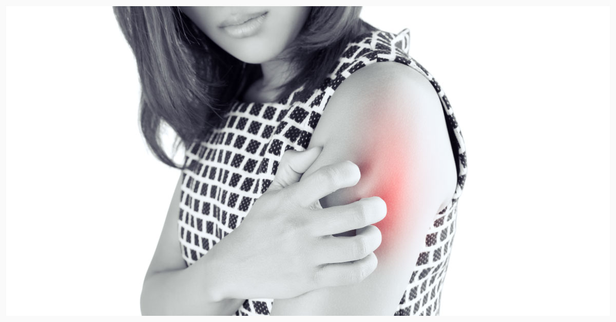 Image of a woman scratching a mosquito bite.